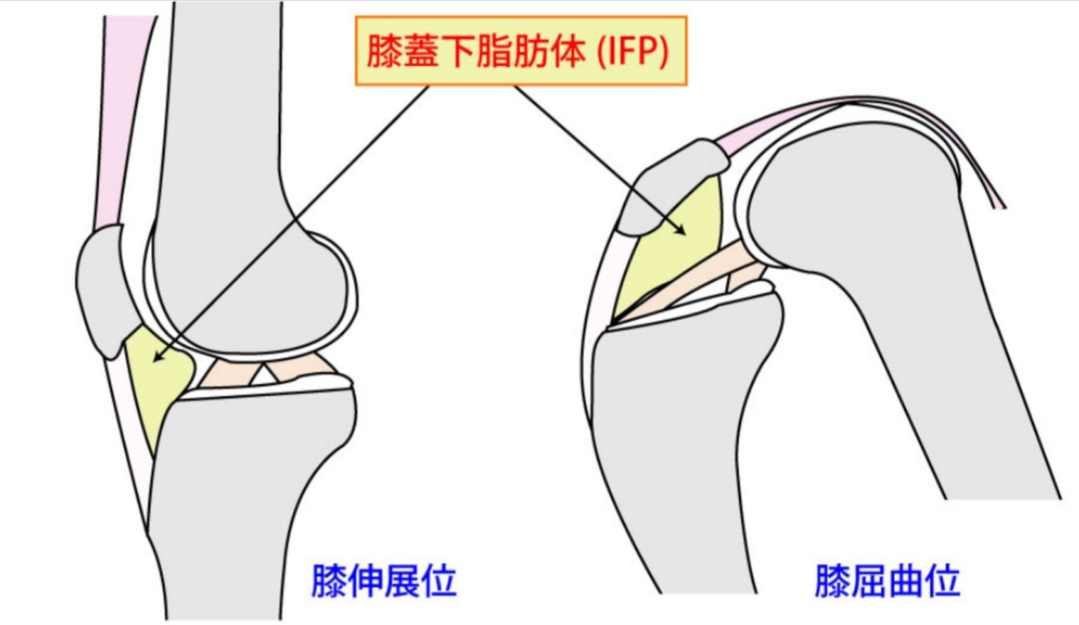 膝の違和感が気になる方へ | 【中区紙屋町】パーソナルトレーニング専門ジム/くびれ美人